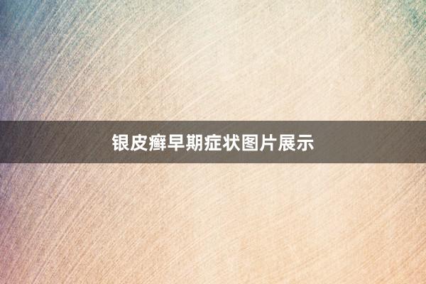 银皮癣早期症状图片展示